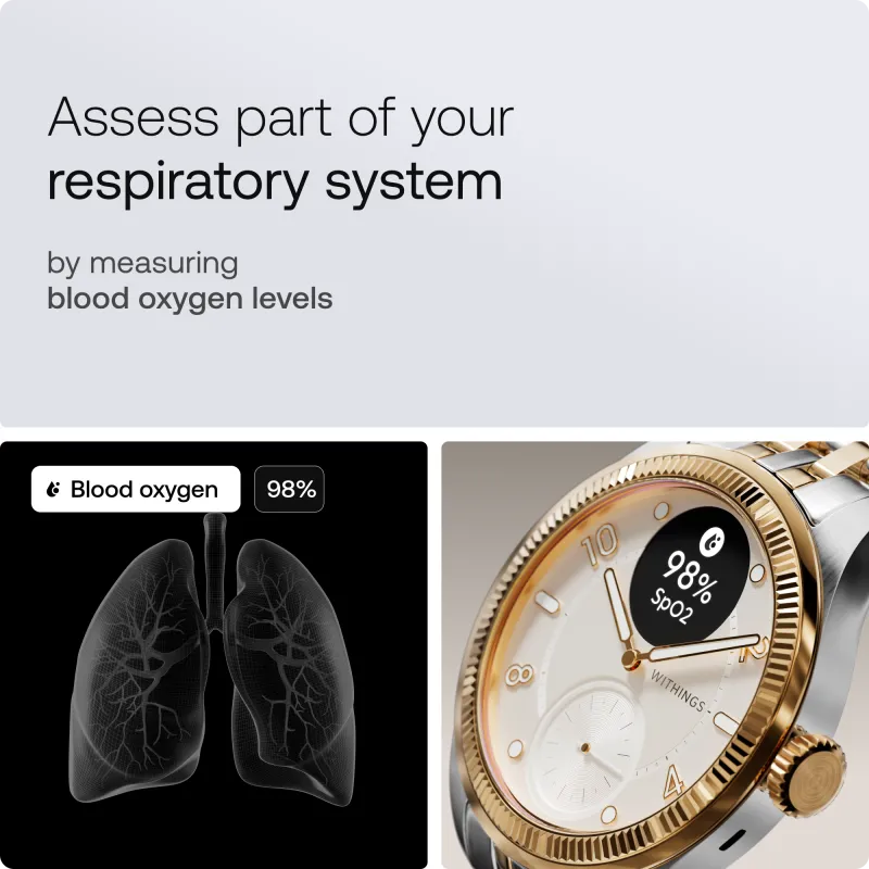 Withings HWA10-MODEL 11-ALL-INT Withings ScanWatch Nova Brilliant 39mm Gold, 3700546710278